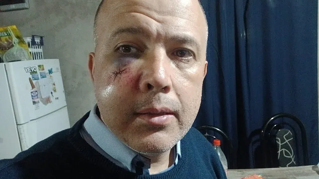 Brutal agresión a un colectivero en Pilar: fue atacado con una manopla